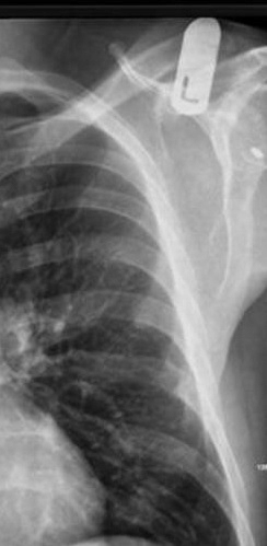 e8f8faea402093ba31d3c03a7672